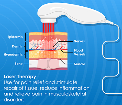 laser therapy treatments in st petersburg