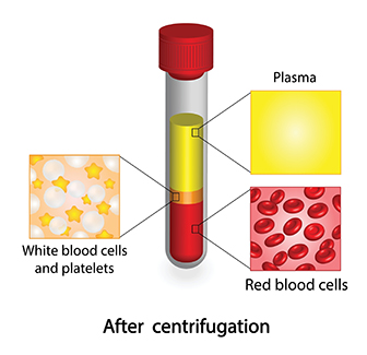 neuropathy treatments in st pete