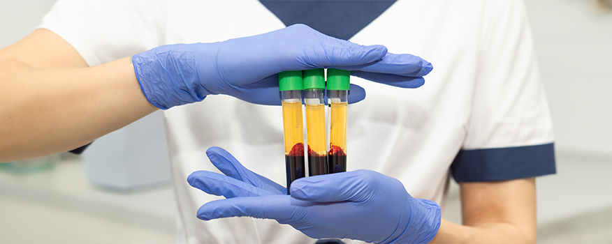 platelet-rich plasma in st petersburg