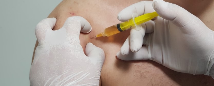 PRP injection for shoulder pain St Petersburg FL regenerative medicine
